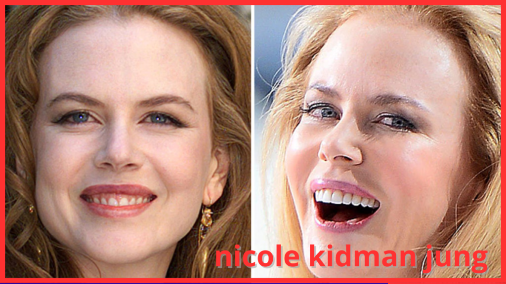 nicole kidman jung